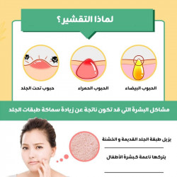 جل التقشير بالصبار