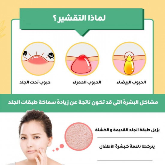 جل التقشير بالصبار