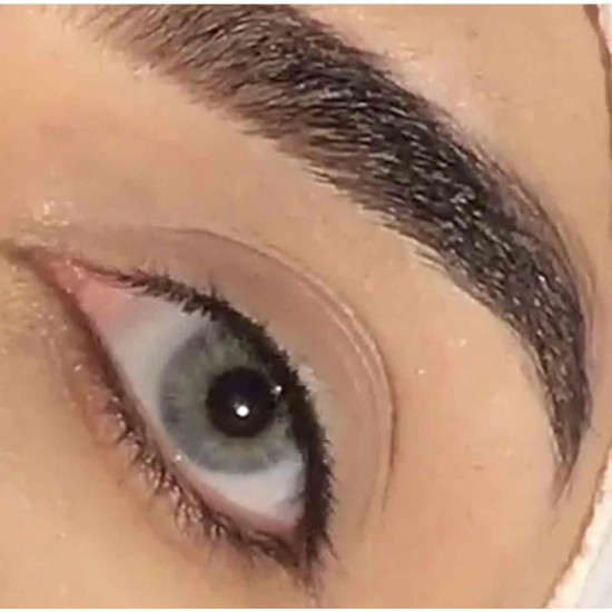 سكاي - عدسات ذهب