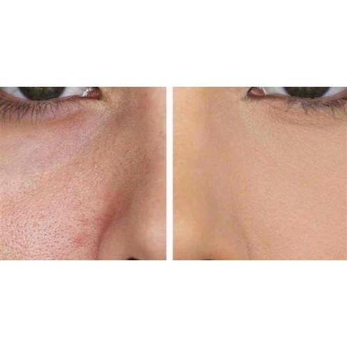 برايمر بيبي سكين من ميبلين  20 مل