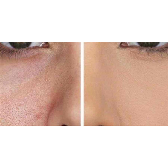 برايمر بيبي سكين من ميبلين  20 مل