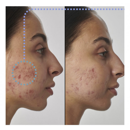 سيروم الريتنول الفائق 1% من ذا إنكي ليست 30مل سيروم الريتنول الفائق 1% من ذا إنكي ليست 30مل