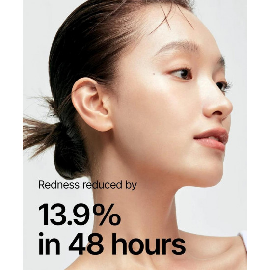 تونر الهارت ليف 77% لتهدئة البشرة من انوا - 250مل تونر الهارت ليف 77% لتهدئة البشرة من انوا - 250مل