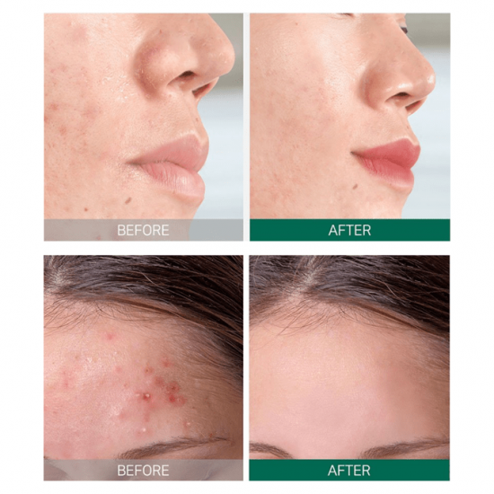 مجموعة روتين العناية AHA. BHA. PHA 30 يوما من سوم باي مي - 4 قطع مجموعة روتين العناية AHA. BHA. PHA 30 يوما من سوم باي مي - 4 قطع