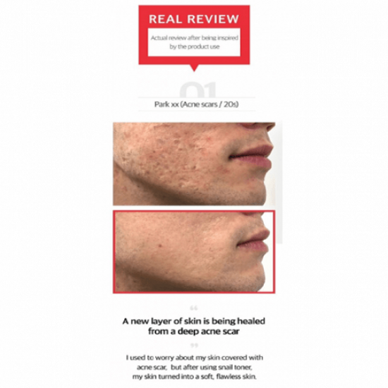 مجموعة الحلزون الاسود لتجديد البشرة من سوم باي مي - 4 قطع مجموعة الحلزون الاسود لتجديد البشرة من سوم باي مي - 4 قطع