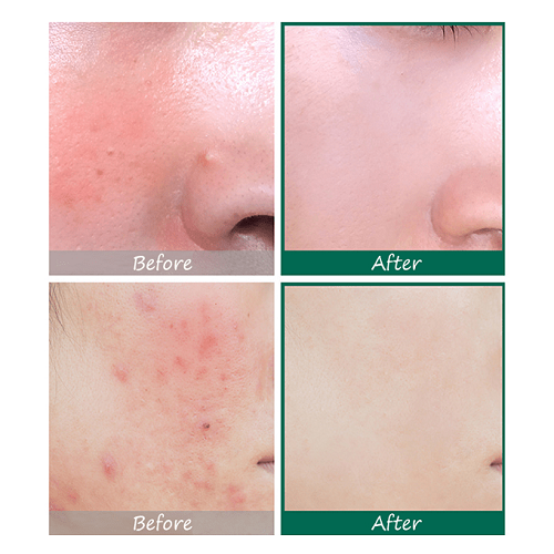 سيروم العناية AHA BHA PHA من سوم باي مي - 50مل سيروم العناية AHA BHA PHA من سوم باي مي - 50مل