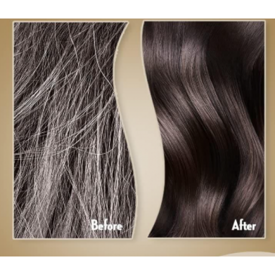 بلسم صانسيلك الحل لتساقط الشعر 350 ملي  بلسم صانسيلك الحل لتساقط الشعر 350 ملي