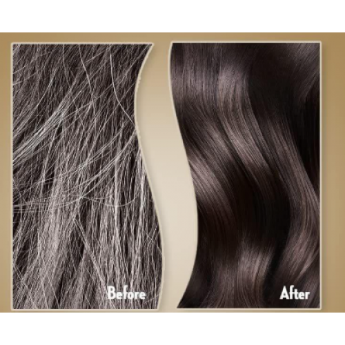 شامبو صانسيلك الحل بتساقط الشعر 700 ملي  شامبو صانسيلك الحل بتساقط الشعر 700 ملي