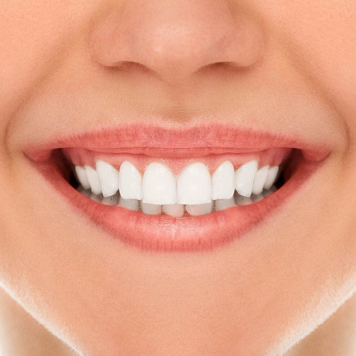 فيتى دينت كريم لطقم الاسنان 40 جم فيتى دينت كريم لطقم الاسنان 40 جم