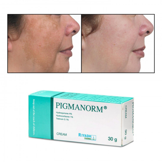 لويس - وايدمر كريم بيجمانورم 30 مل لويس - وايدمر كريم بيجمانورم 30 مل