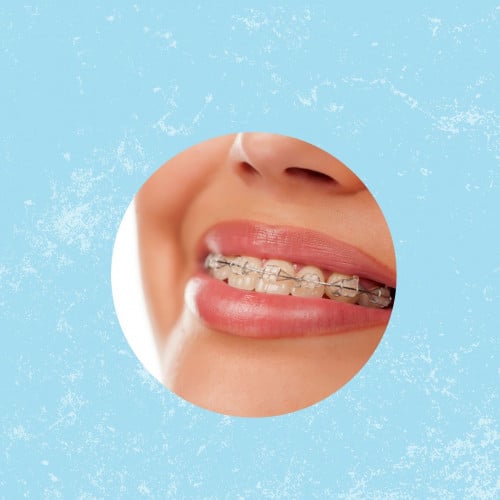 اضافة التقويم الشفاف